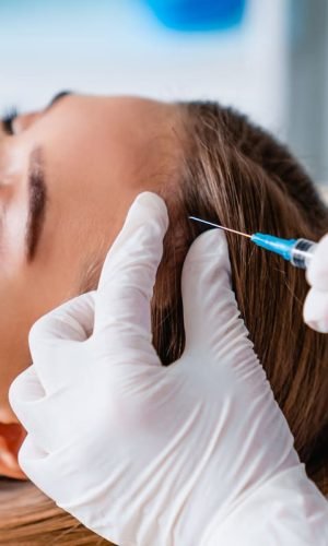 Cuál es la mejor cirugía capilar para el cabello